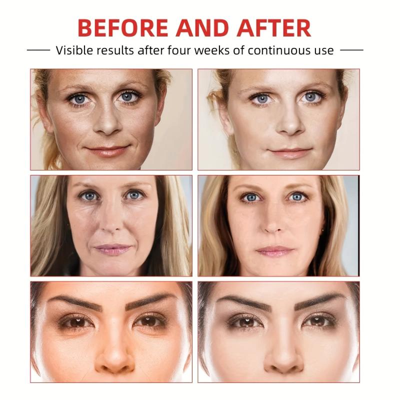 Wrinkle Diminishing Cream with Hyaluronic Acid & Vitamin C
