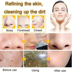 Deep Cleansing Activated Charcoal Peel Off Face Mask