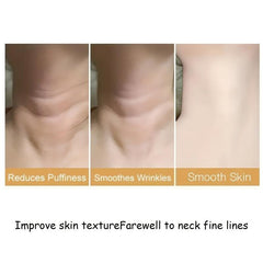 Neck Lifting Tightening Cream Fade Fine Lines Neck Filling Cream