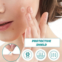 Acne Pimple Patch for Covering Zits and Blemishes - Vegan Friendly