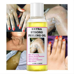 Dark Skin Yellow Peeling Solution Exfoliates Body