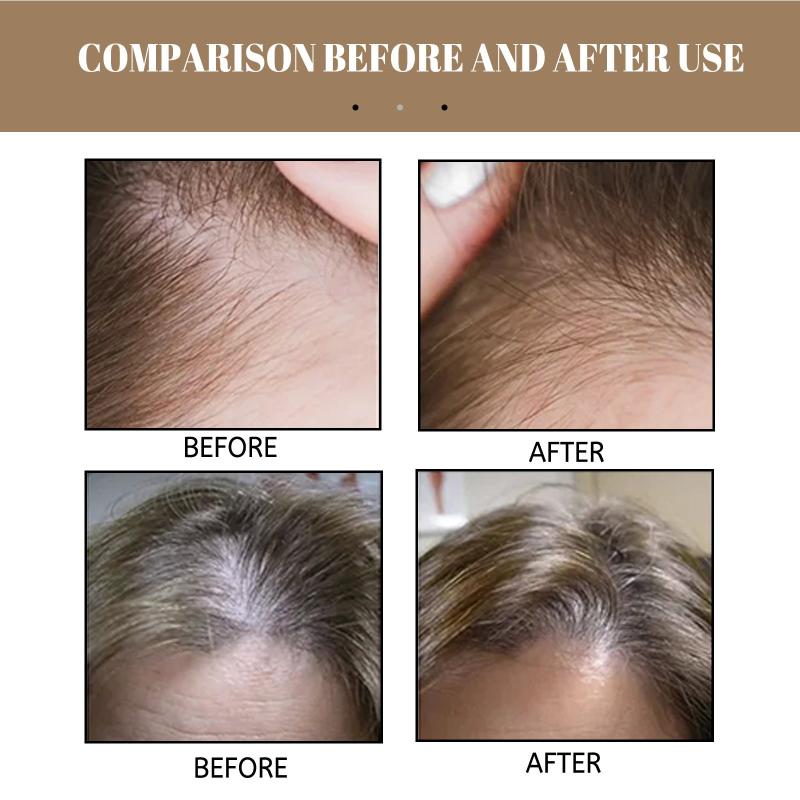 100g Natural Rice Shampoo Soap Repairs Bifurcated Damaged Hair