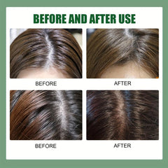 Rosemary Scalp Scrub: Exfoliates Scalp, Refreshes, Moisturizes - 100g