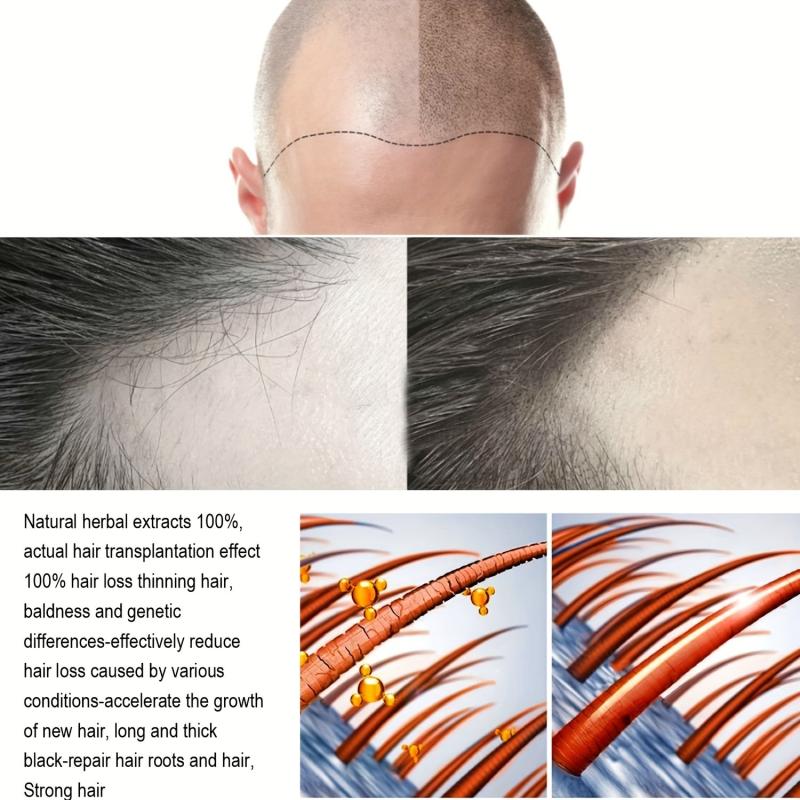 50g Natural Hair Thickening Cream for Stronger Hair