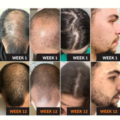 Hair Thickening Cream for All Hair Types