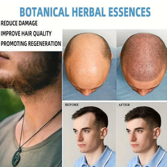 50g Hair Strengthening Cream for Thicker & Healthier Hair