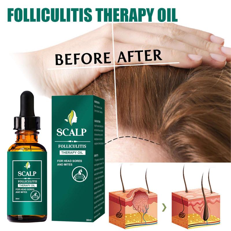 Peppermint Scalp Hair Care - Split Ends & Dry Scalp - All Hair Types