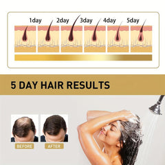 Ginger Hair Shampoo Repairs Split Ends And Repairs Damaged Hair