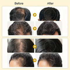 30ml Biotin Essence Hair Care Spray For All Hair Types