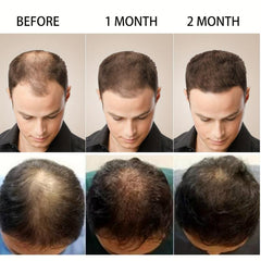 30ml Biotin Essence Hair Care Spray For All Hair Types