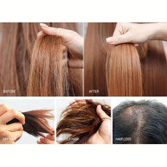 30ml 5 Minoxidil Caffeine Serum Hair Care Serum For Men And Women