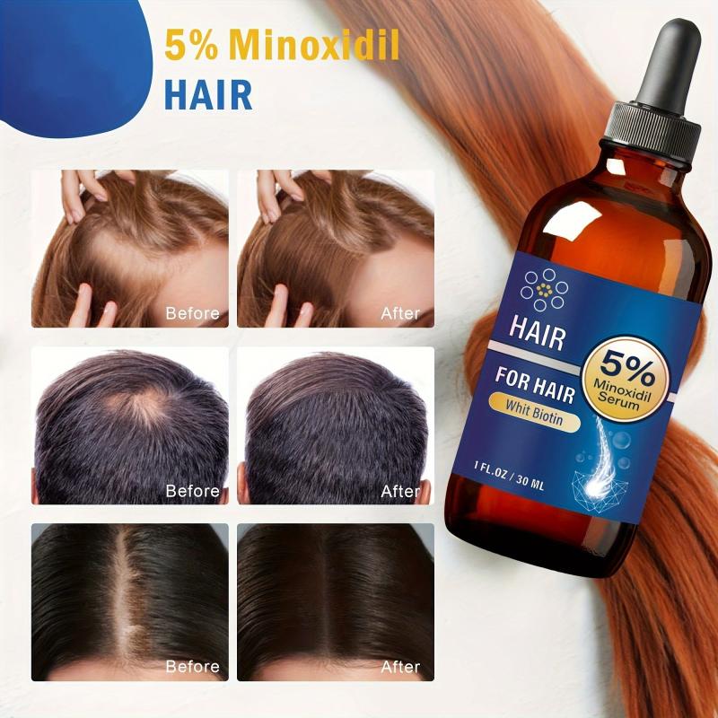 30ml 5 Minoxidil Caffeine Serum Hair Care Serum For Men And Women