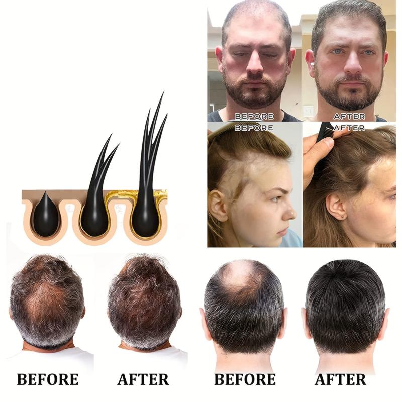 30ml Ginger Hair Serum Repair Damaged Dry Hair