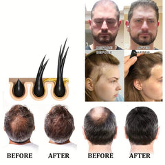 30ml Ginger Hair Serum Repair Damaged Dry Hair