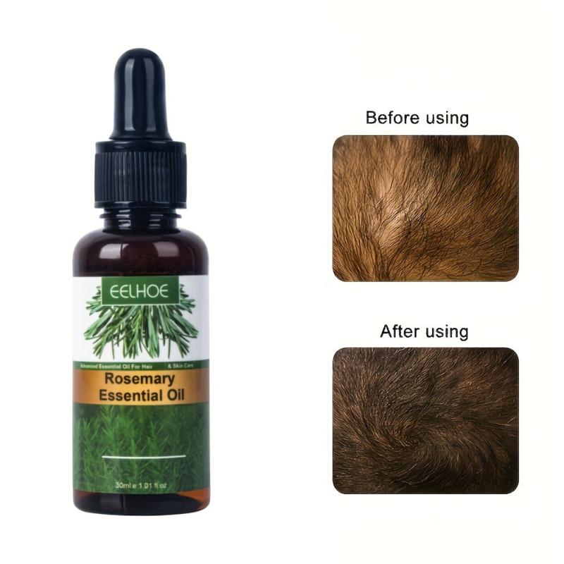 30ml 2pcs 7 Days Hair Serum With Rosemary & Ginger Revitalizes Hair Root To Tip
