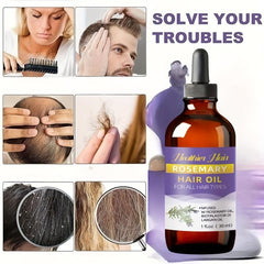 30ml Rosemary Essential Hair Care For All Hair Types