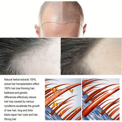 30ml Ginger Hair Essence Spray for All Hair Types