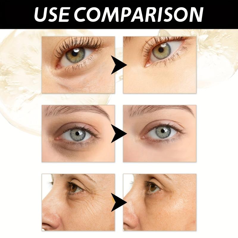 Retinol Eye Cream Fine Lines Puffiness Dark Circles Bags