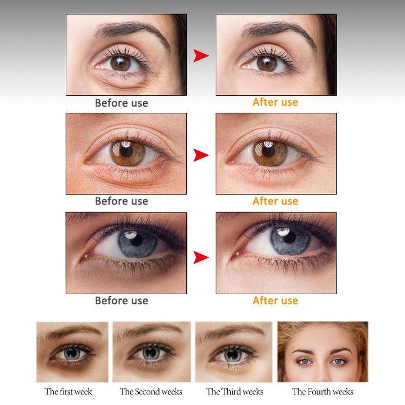 Wrinkle Peptide Serum Eye Massager Skin Care Swelling Dark Circles