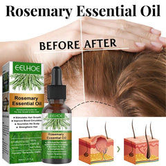Rosemary Hair Care Solution for Stronger Softer Hair