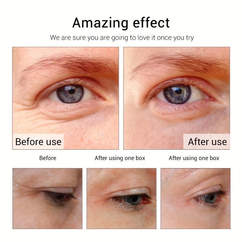 Eye Cream 20g Peptide Collagen Serum Wrinkle Diminishing Aging Resisting Remover