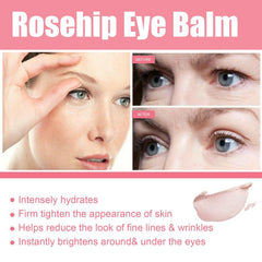 Rosehip Eye Cream Stick Dark Circles Fine Lines Moisturizing