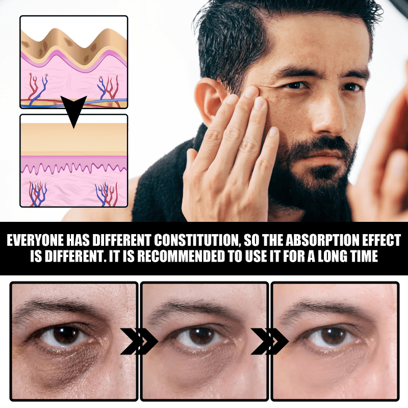 Men's Eye Cream for Dark Circles & Fine Lines - Hydrating & Tightening Formula