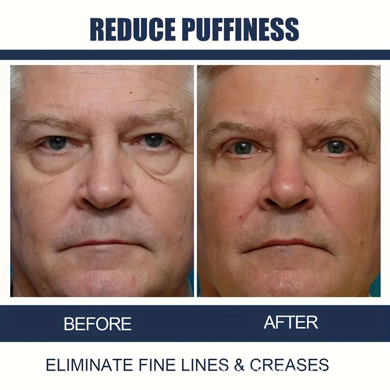 Dark Circle Eye Cream Reduce Wrinkles