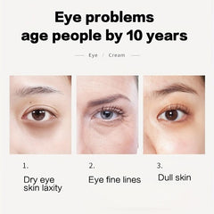 Caviar Golden Essence Eyes Cream Moisturizing & Firming