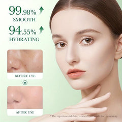 50g Centella Asiatica Face Cream for Acne with Natural Ingredients