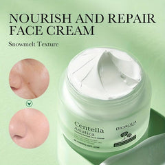 50g Centella Asiatica Face Cream for Acne with Natural Ingredients
