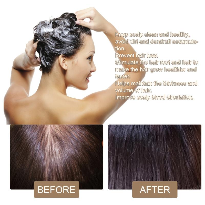 Hair Growth Shampoo Soap Rice Dropping Preventing Nourishing Hair Care