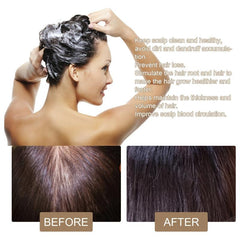 Hair Growth Shampoo Soap Rice Dropping Preventing Nourishing Hair Care