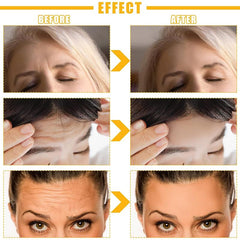 10Pcs Forehead Wrinkle Patches with Hydrolyzed Collagen - Reduce Fine Wrinkles