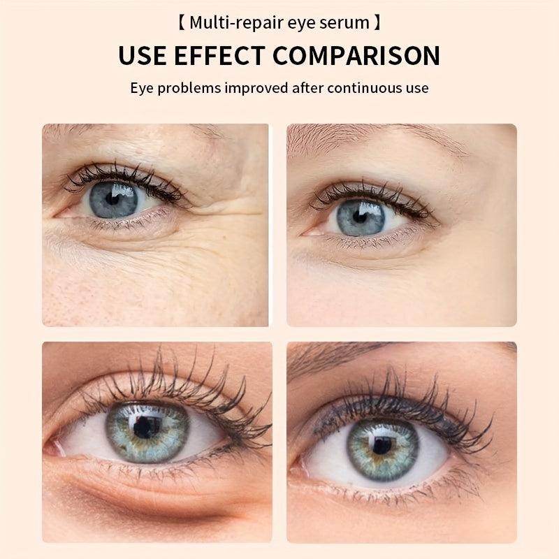 Firming Eye Serum Reduces Dark Circles Wrinkle Serum Bags Fine Lines Puffiness