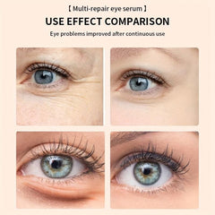 Firming Eye Serum Reduces Dark Circles Wrinkle Serum Bags Fine Lines Puffiness
