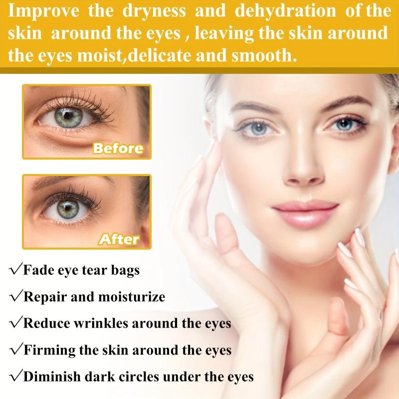 Vitamin E Eye Cream Reduce Dark Circles Crow's Feet