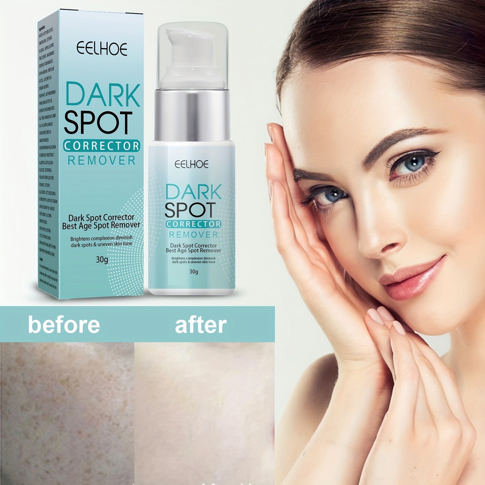 Dark Spot Remover Cream For All Skin Types