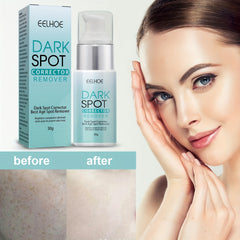 Dark Spot Remover Cream For All Skin Types