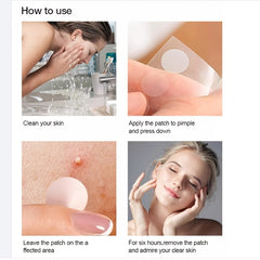 Acne Pimple Patches Hydrocolloid Stars 36pcs