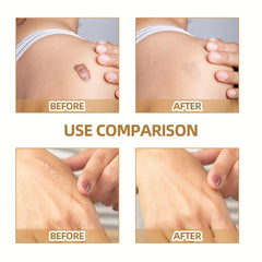 60pcs Invisible Concealer Stickers For Scars Acne Marks Waterproof Skin Tone