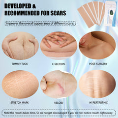 Silicone Scar Sheets 6 Pcs for Old & New Scars
