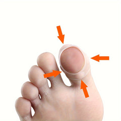 8pcs Nail Inserts Toe Orthotics Corrector Prevent Ingrown Curved Toenails