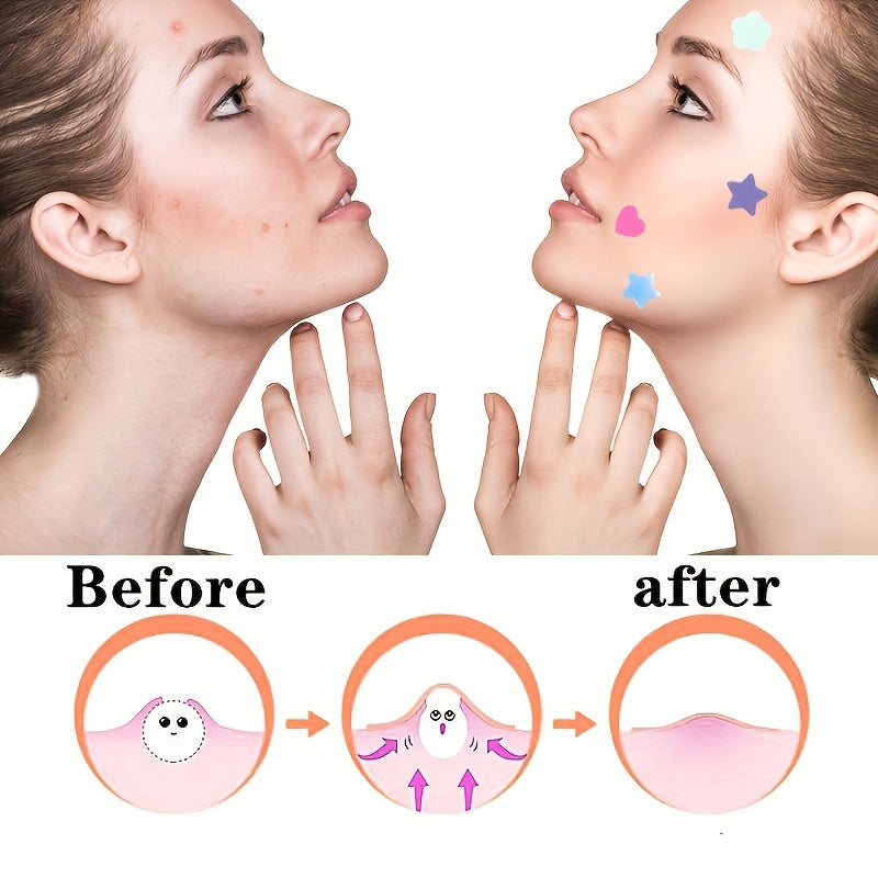 Heart Shape Acne Pimple Patch Spot Stickers