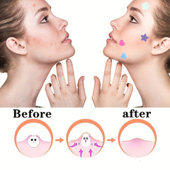 Heart Shape Acne Pimple Patch Spot Stickers