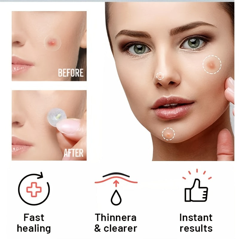 Acne Pimple Patches Hydrocolloid Stars 36pcs